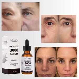 Matrixyl 3000, Argireline, Vitamin C Hyaluronic Acid Peptide Wrinkle Ser…